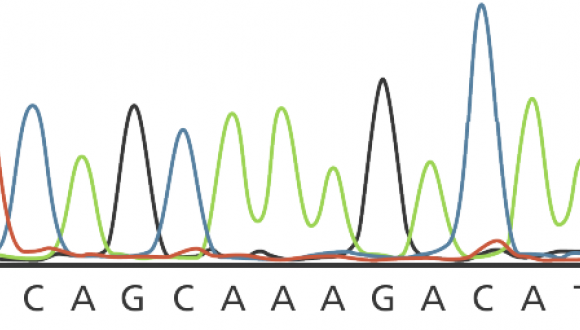 Hereditary Recurrent Fevers HRF